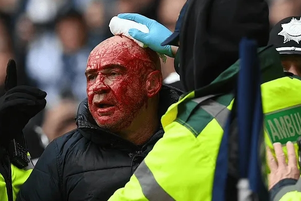 英国足球暴力冲突致比赛中断